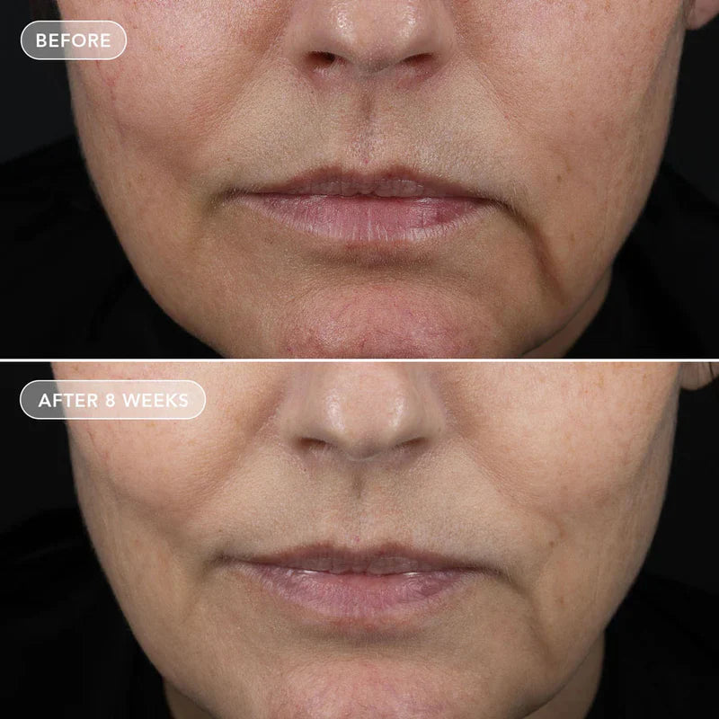 Image Skincare VOL.U.LIFT™ 4D Skin Rebound Complex