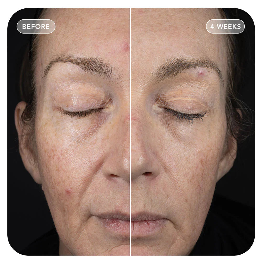 Image Skincare VOL.U.LIFT™ 4D Skin Rebound Complex