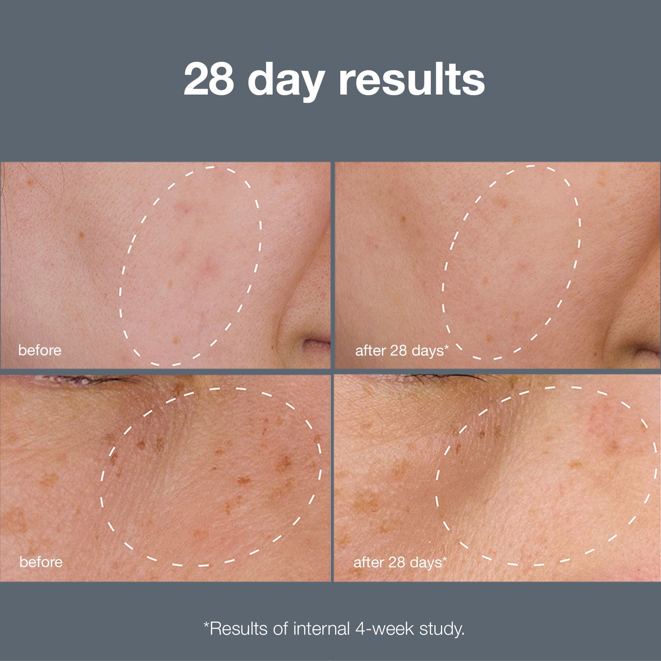 Dermalogica Powerbright Dark Spot System