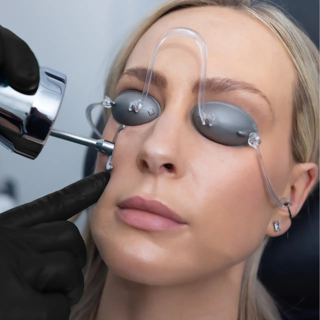 Ultimate Skin Rejuvenation Duo BBL+Laser Peel (save up to €501)