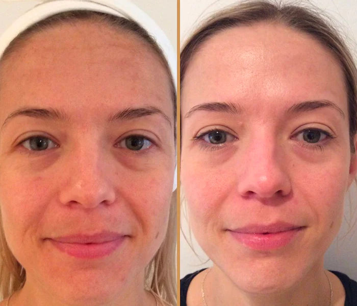 hydrafacial-3-copy-1680180496514.webp__PID:821de0a5-0cc4-4297-b3c7-805f1155c347