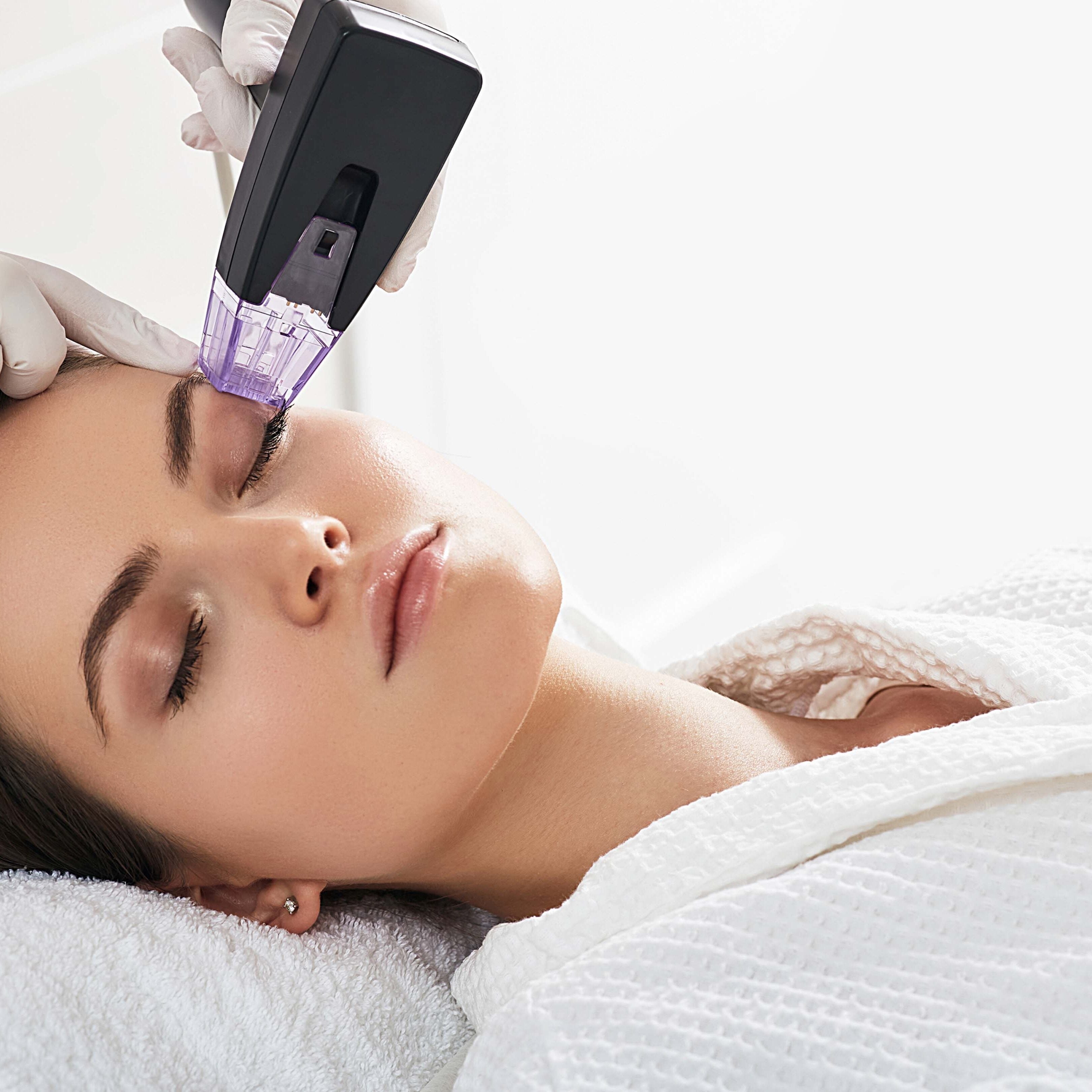 Morpheus8 Burst RF Microneedling Course of 2 (save up to €901)