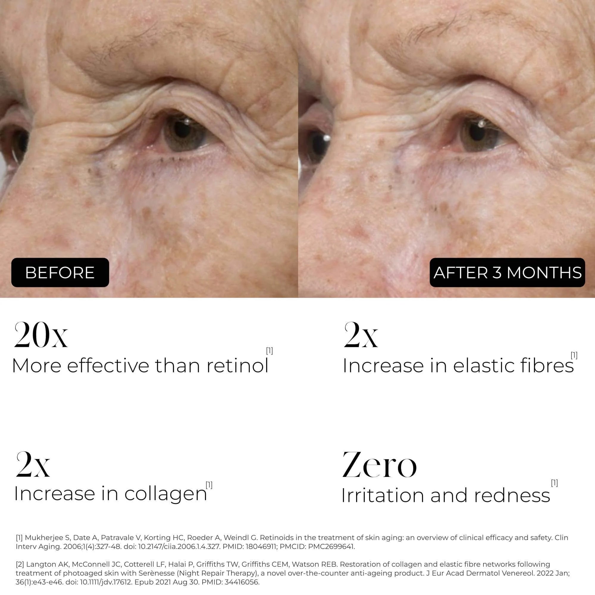 Before and after comparison of skin treatment effects with text highlighting benefits.