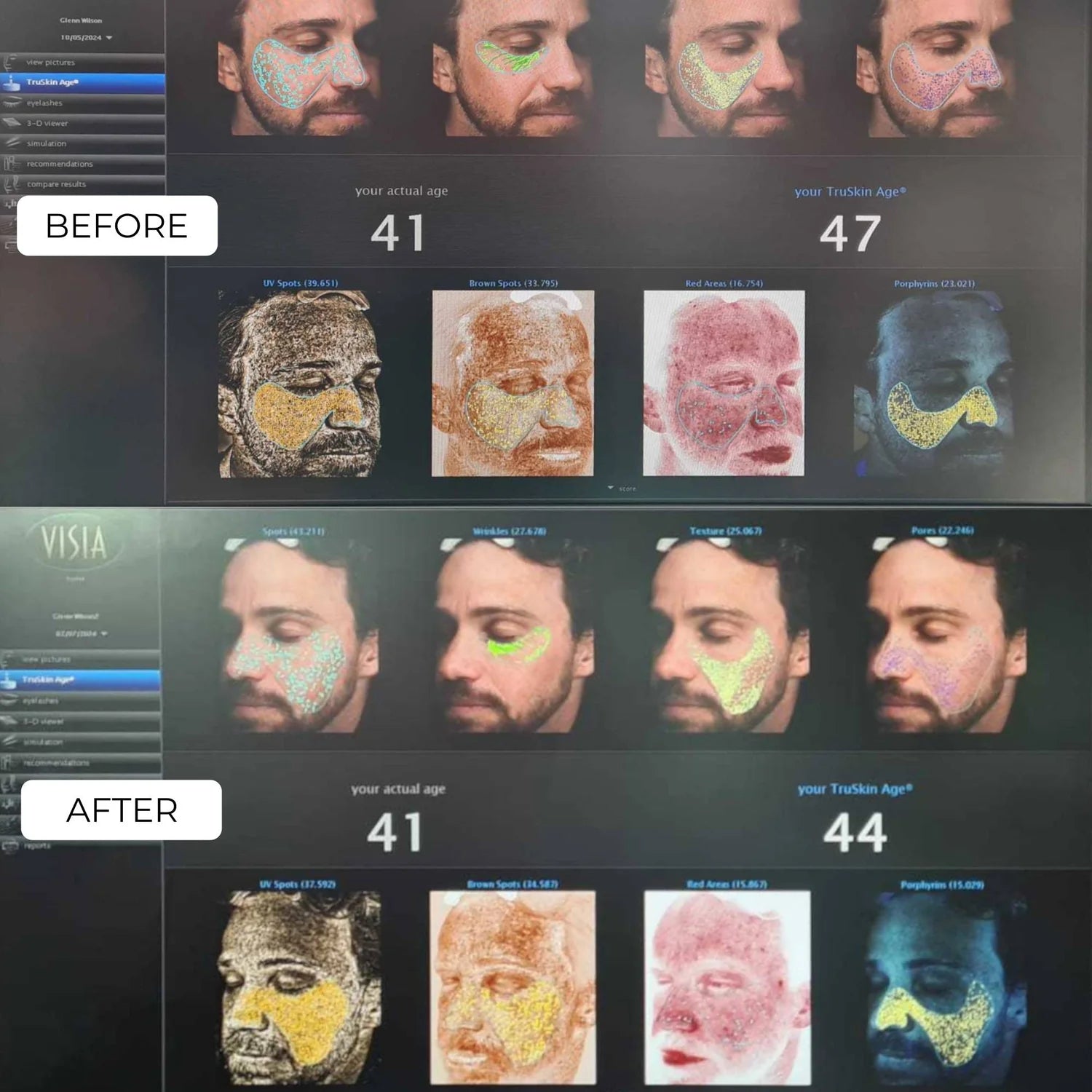 Before and after digital aging effect on a person's face with detailed analysis tools on the side.