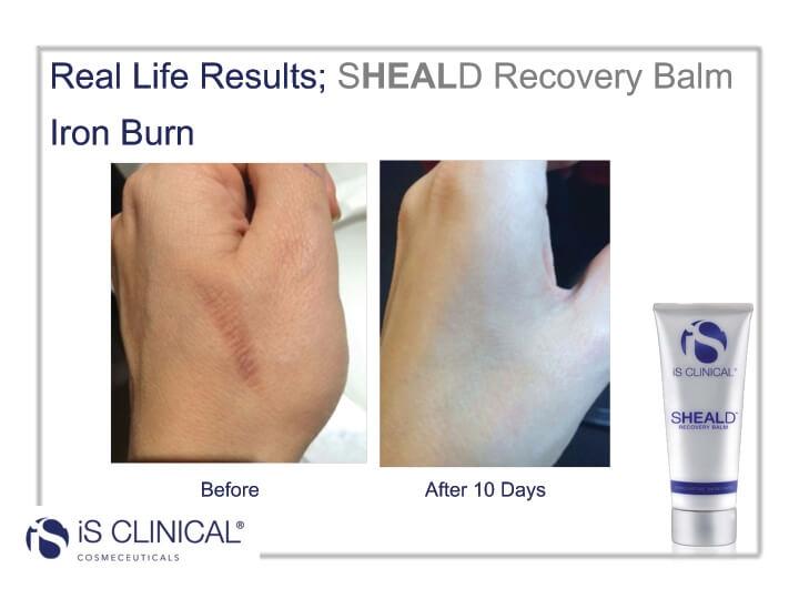 iS Clinical SHEALD Recovery Balm 60g