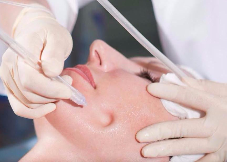 JetPeel Luxury Vitamin Infusion Facial 50-Mins