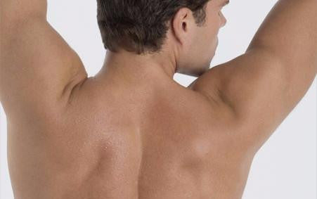 Laser Hair Removal for Men Full Back & Shoulders (as low as €99.90 per session)